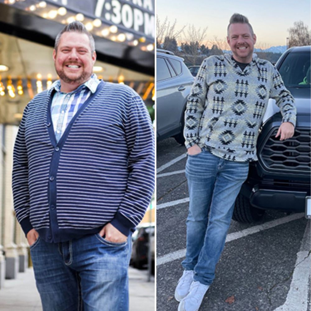 Bryce B. before and after